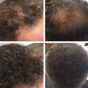 Top Hair Loss & Restoration Clinic 